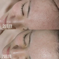 画像261