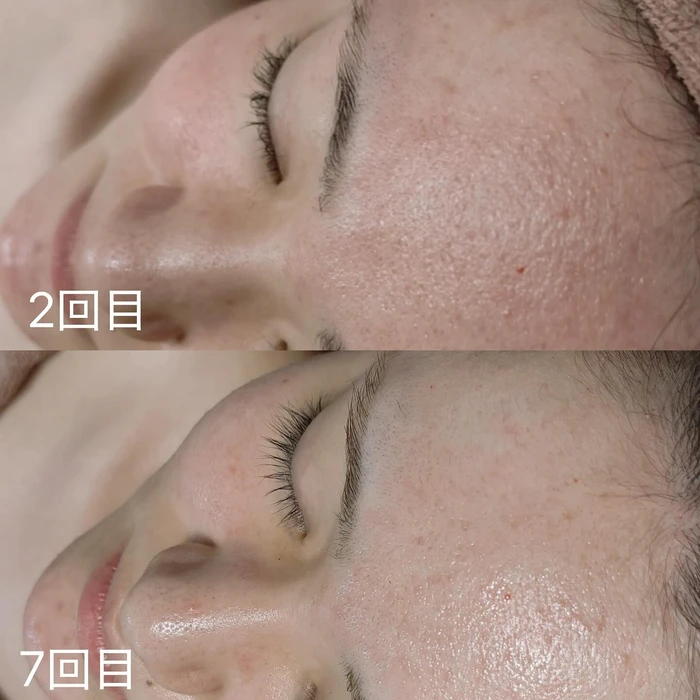 画像261