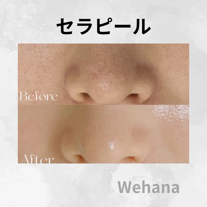 画像314