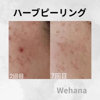 画像316