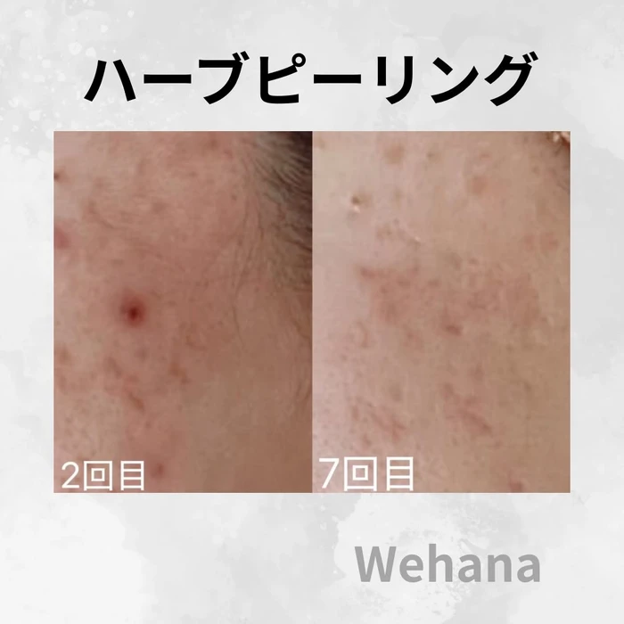 画像316