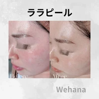 画像320