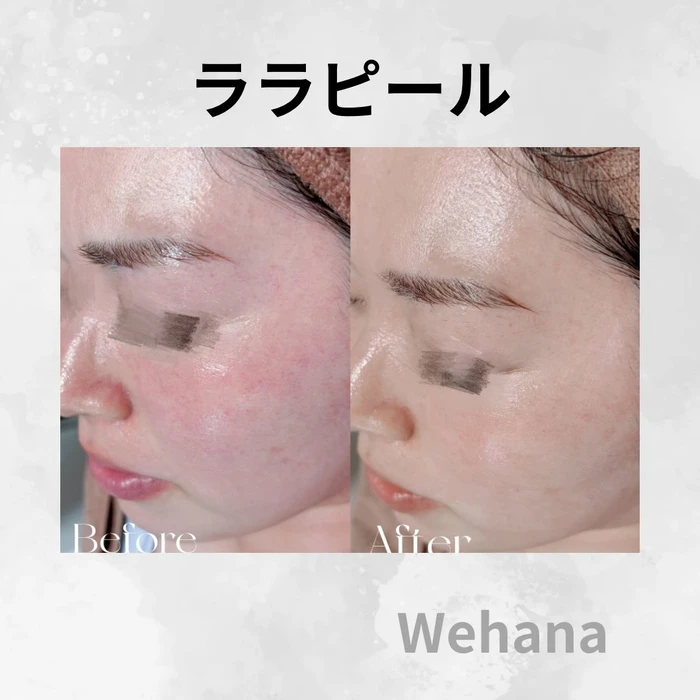 画像320