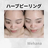 画像322