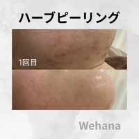 画像324