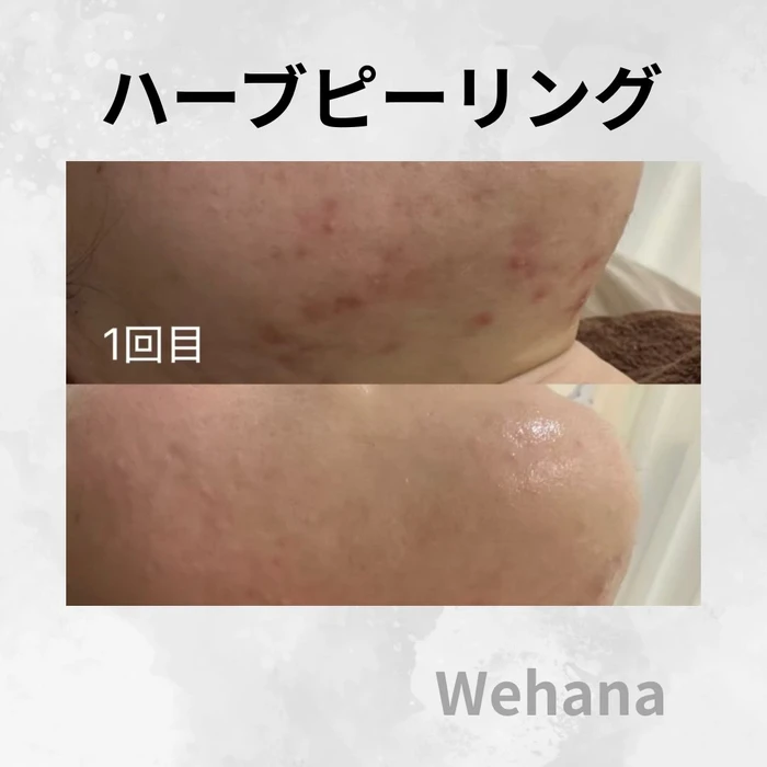 画像324