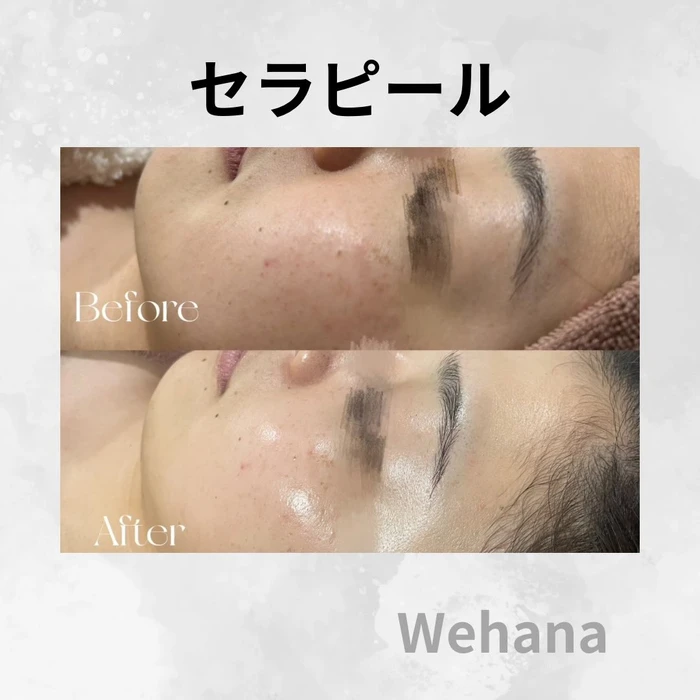 画像326