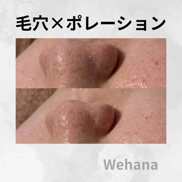 画像328
