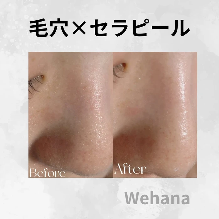 画像330