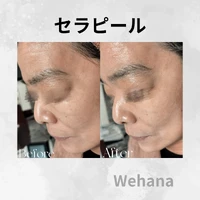 画像332