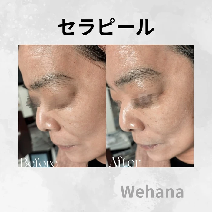 画像332