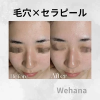 画像334