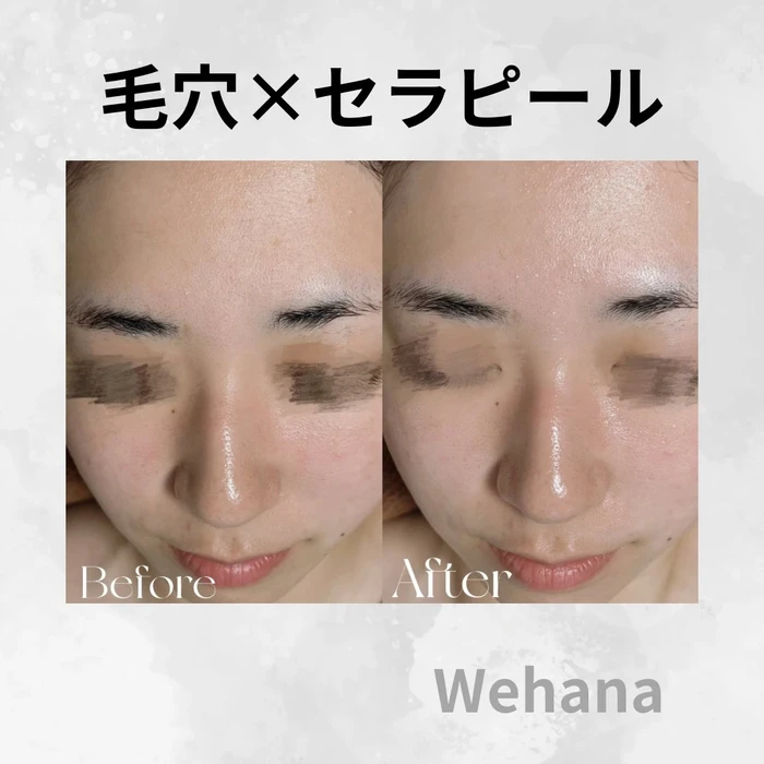 画像334