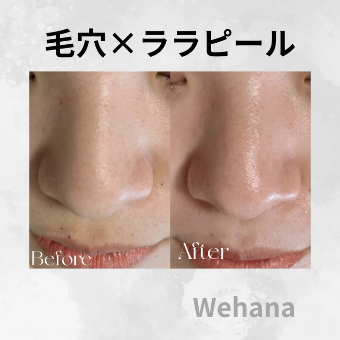 画像336