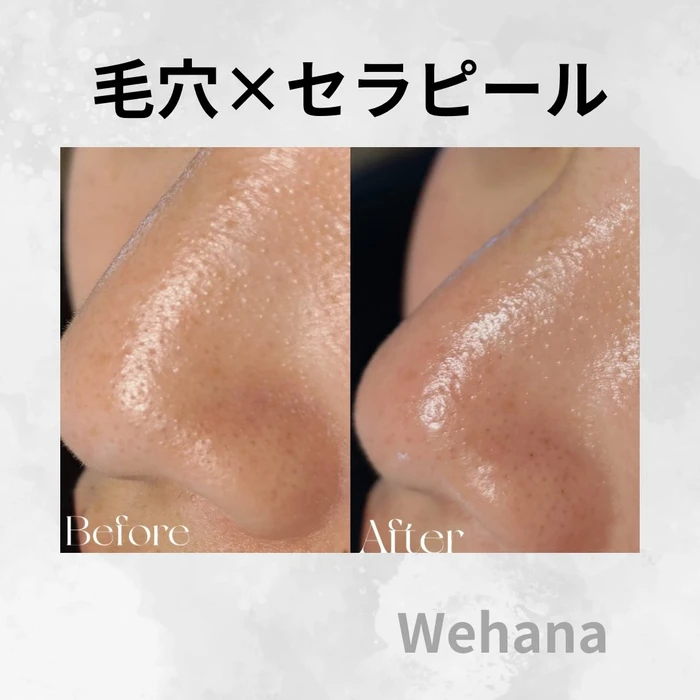 画像338