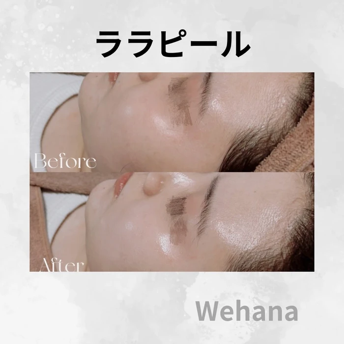画像340