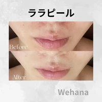画像342