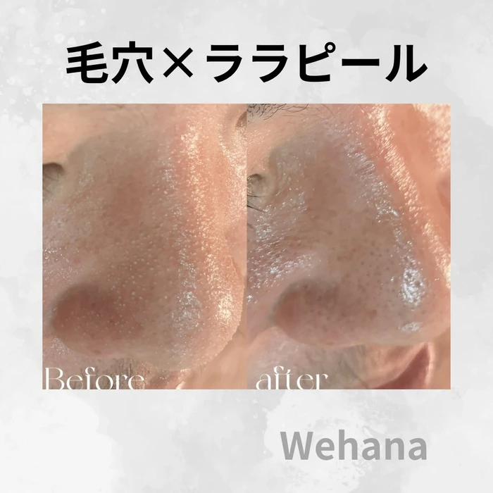 画像398